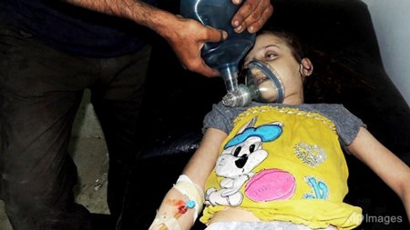 Một bé gái người Syria được chăm sóc tại bệnh viện dã chiến sau vụ tấn công hồi tuần trước